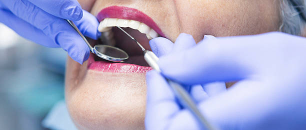 Best Emergency Dentist for Lost Fillings or Crowns in Peoria, AZ